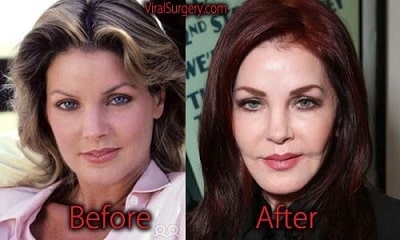 A picture of Priscilla Presley before (left) and after (right).